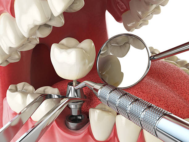 Best Emergency Dental Extractions in Sherrill, NY